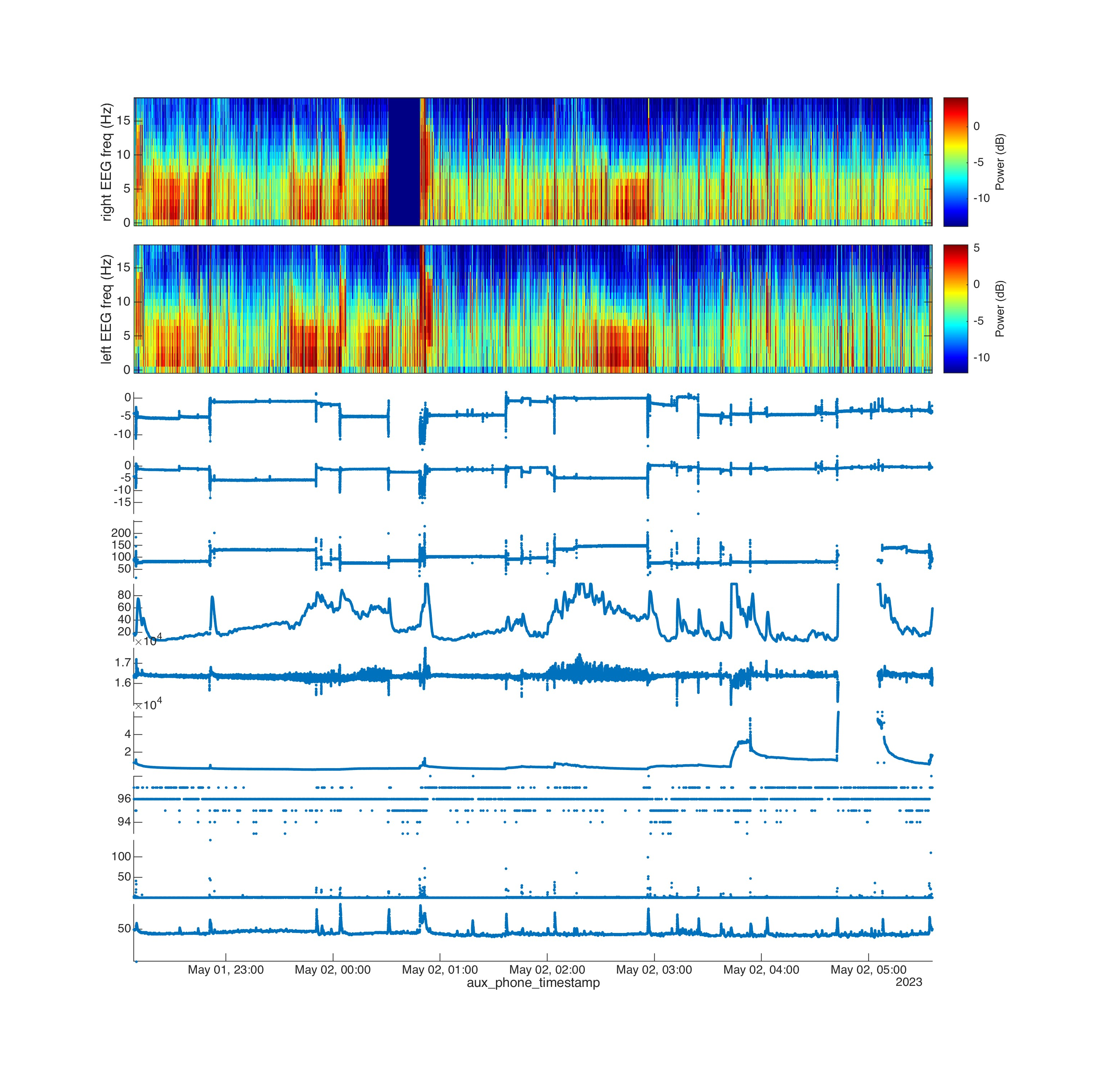 Innovative Sleep monitoring